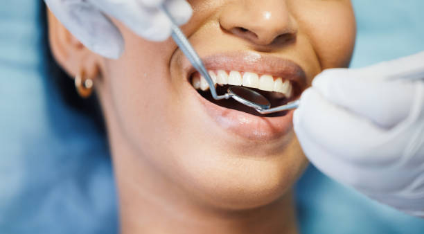 Best Urgent Tooth Repair  in La Presa, CA