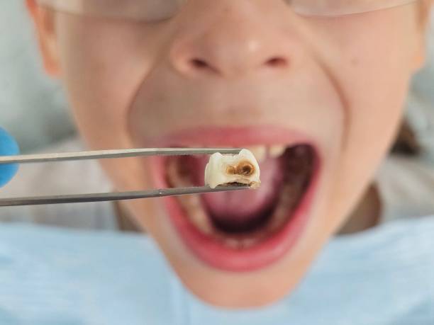 Best 24-Hour Emergency Dentist  in La Presa, CA