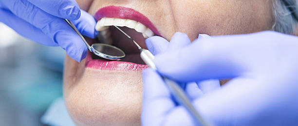 Best Knocked-Out Tooth Emergency  in La Presa, CA